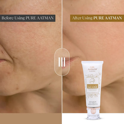 Pure Gentle Exfoliating Face Scrub Gentle Exfoliation for Smooth, Brighter-Looking Skin
