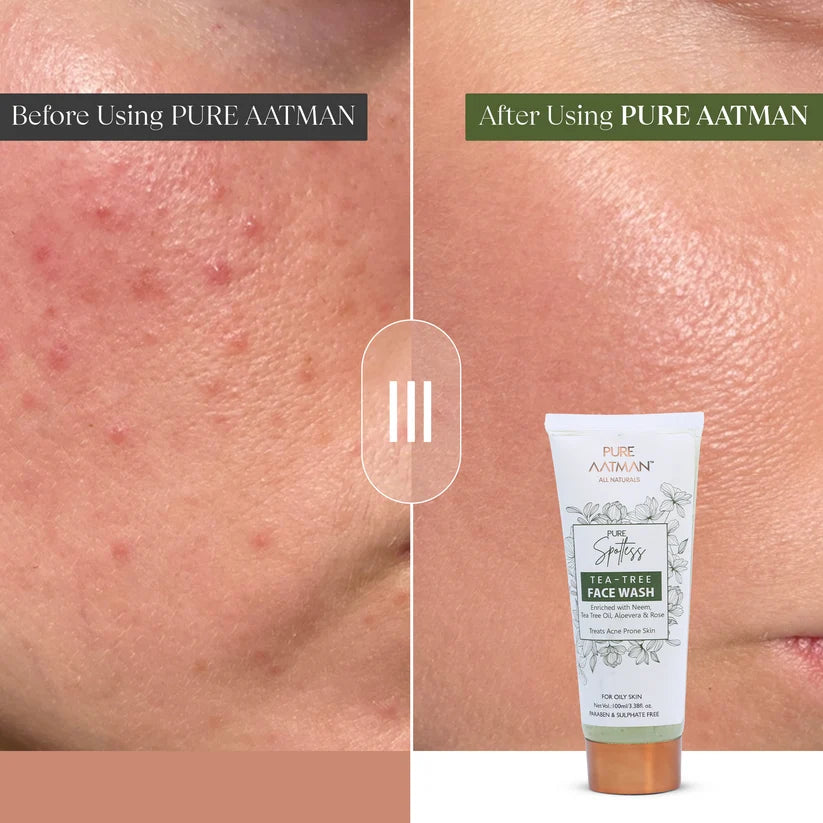 Pure Spotless Tea Tree Face Wash For Oily & Acne-Prone Skin