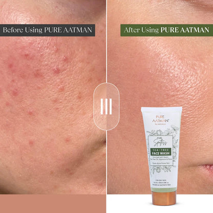 Pure Spotless Tea Tree Face Wash For Oily & Acne-Prone Skin
